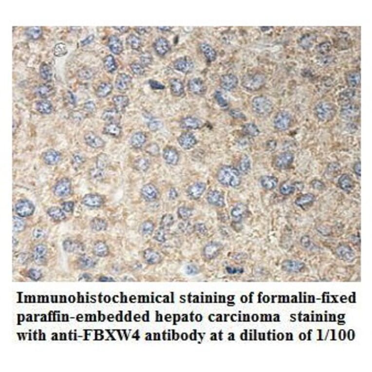 FBXW4 Antibody from Signalway Antibody (39899) - Antibodies.com