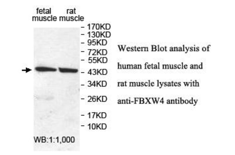 FBXW4 Antibody from Signalway Antibody (39899) - Antibodies.com