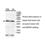 FBXW4 Antibody from Signalway Antibody (39899) - Antibodies.com