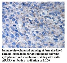 ARAP3 Antibody from Signalway Antibody (39906) - Antibodies.com