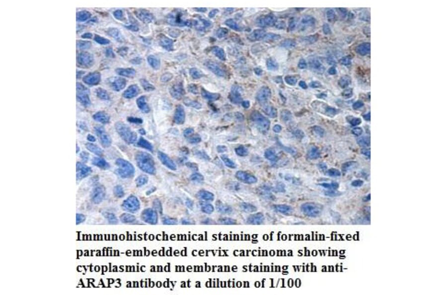 ARAP3 Antibody from Signalway Antibody (39906) - Antibodies.com