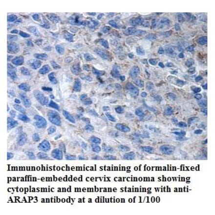 ARAP3 Antibody from Signalway Antibody (39906) - Antibodies.com