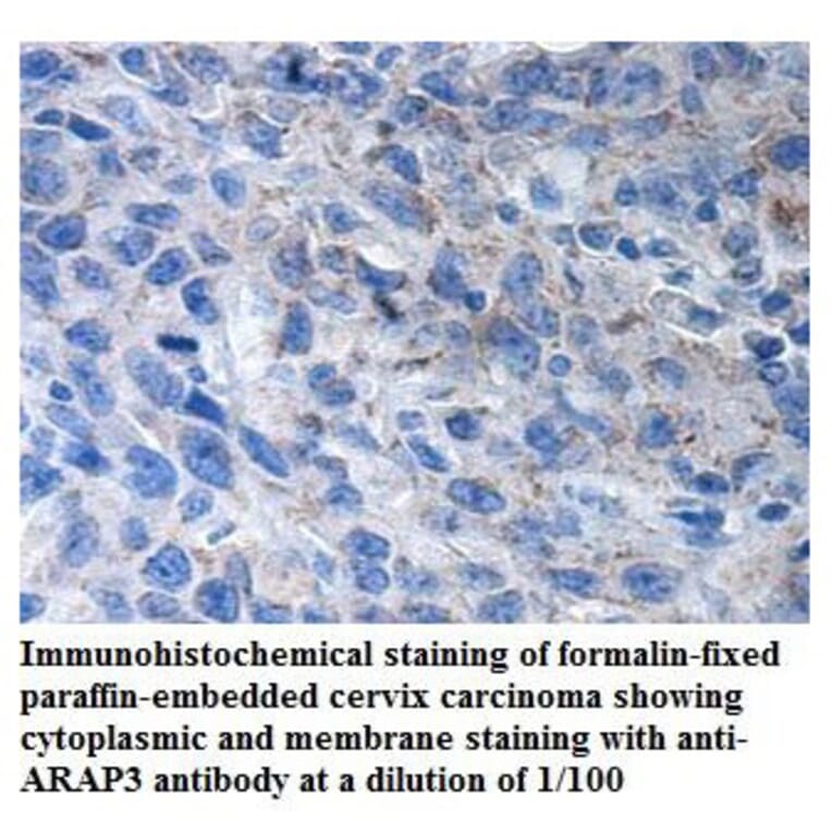 ARAP3 Antibody from Signalway Antibody (39906) - Antibodies.com