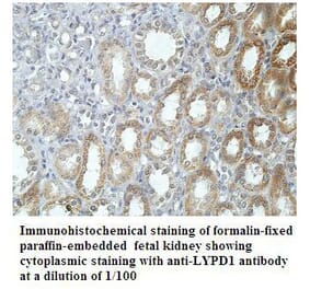 LYPD1 Antibody from Signalway Antibody (39909) - Antibodies.com