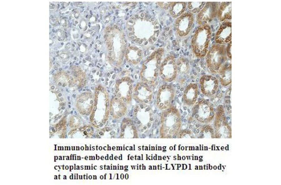 LYPD1 Antibody from Signalway Antibody (39909) - Antibodies.com