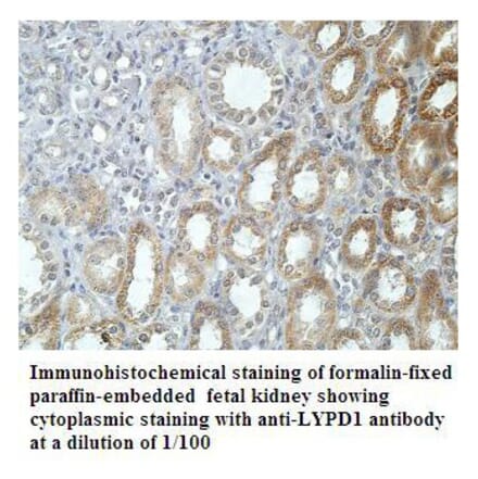 LYPD1 Antibody from Signalway Antibody (39909) - Antibodies.com