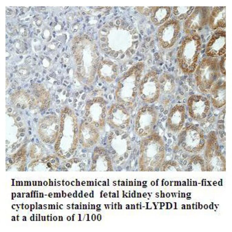 LYPD1 Antibody from Signalway Antibody (39909) - Antibodies.com