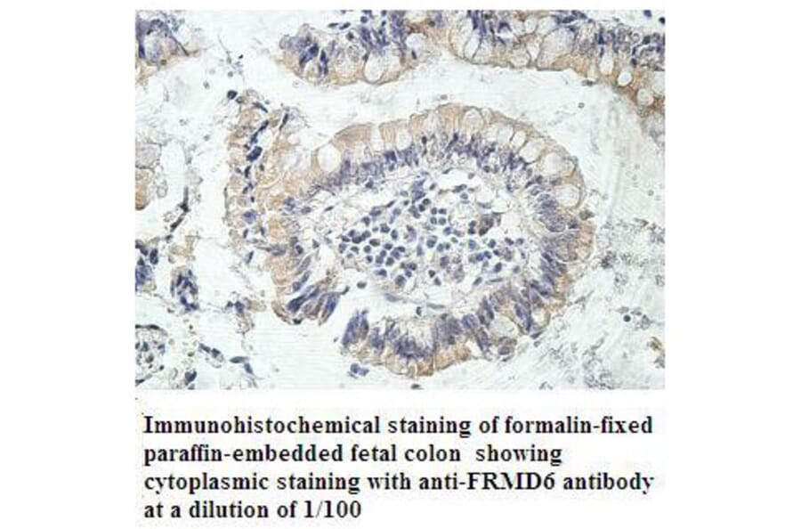 FRMD6 Antibody from Signalway Antibody (39914) - Antibodies.com