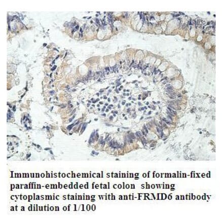 FRMD6 Antibody from Signalway Antibody (39914) - Antibodies.com