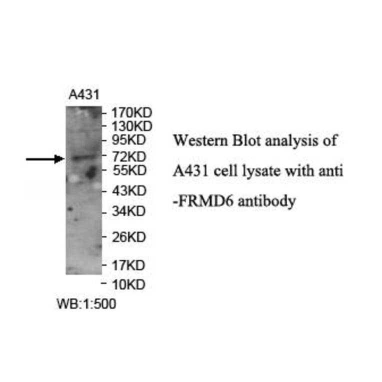 FRMD6 Antibody from Signalway Antibody (39914) - Antibodies.com