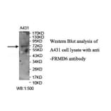 FRMD6 Antibody from Signalway Antibody (39914) - Antibodies.com