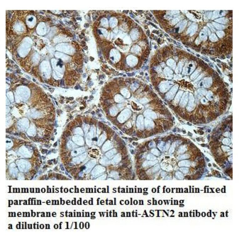 ASTN2 Antibody from Signalway Antibody (39916) - Antibodies.com