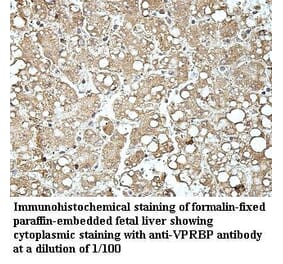 VprBP Antibody from Signalway Antibody (39965) - Antibodies.com