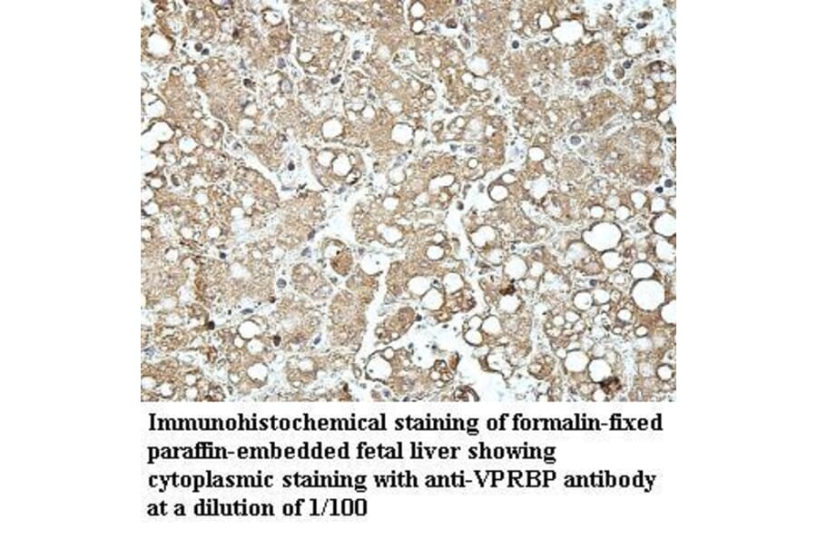 VprBP Antibody from Signalway Antibody (39965) - Antibodies.com