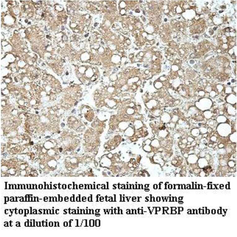 VprBP Antibody from Signalway Antibody (39965) - Antibodies.com