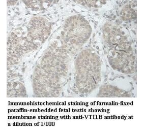 VTI1B Antibody from Signalway Antibody (39966) - Antibodies.com