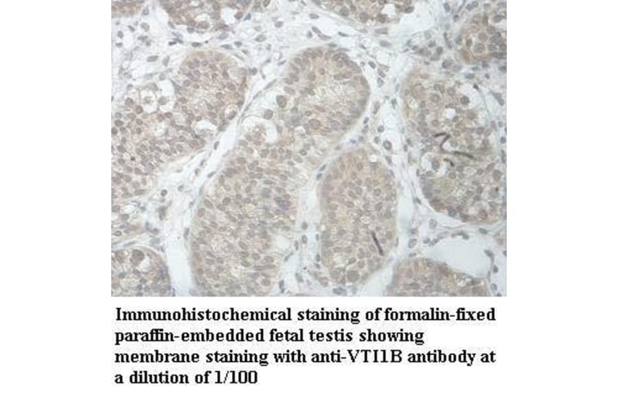 VTI1B Antibody from Signalway Antibody (39966) - Antibodies.com