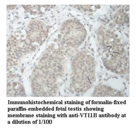 VTI1B Antibody from Signalway Antibody (39966) - Antibodies.com