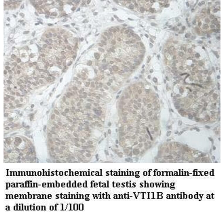 VTI1B Antibody from Signalway Antibody (39966) - Antibodies.com