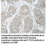 VTI1B Antibody from Signalway Antibody (39966) - Antibodies.com