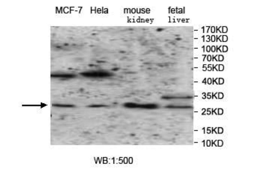 VTI1B Antibody from Signalway Antibody (39966) - Antibodies.com