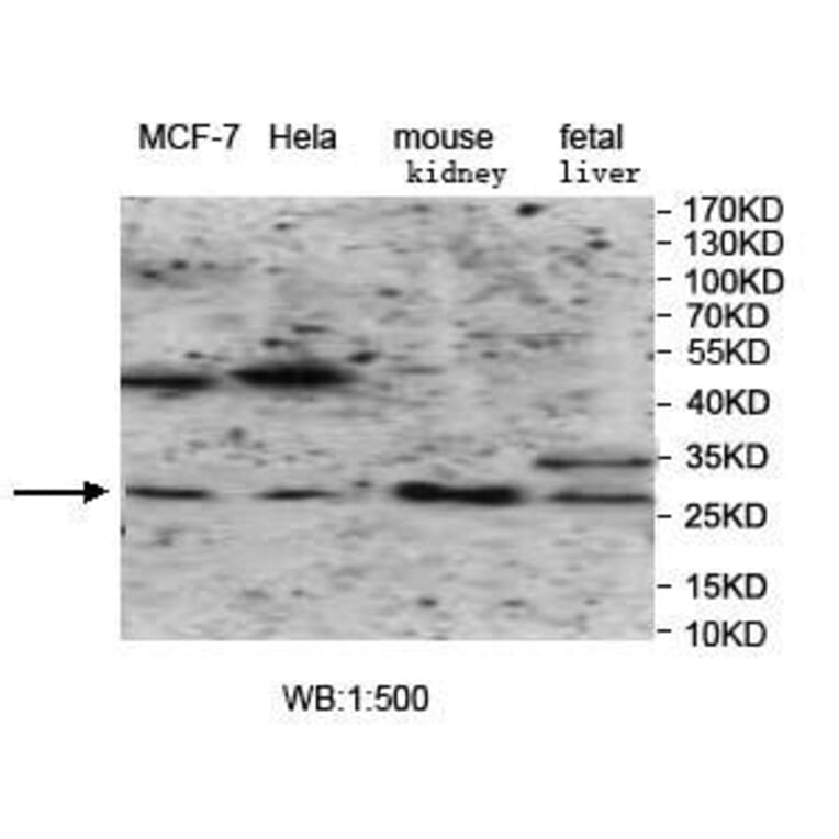 VTI1B Antibody from Signalway Antibody (39966) - Antibodies.com