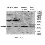 VTI1B Antibody from Signalway Antibody (39966) - Antibodies.com
