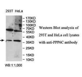 PPP6C Antibody from Signalway Antibody (39981) - Antibodies.com