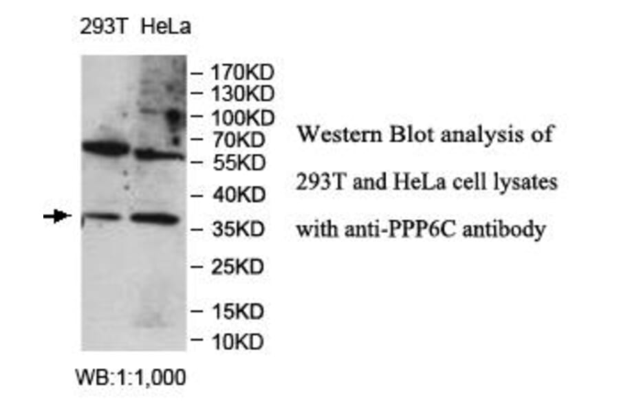 PPP6C Antibody from Signalway Antibody (39981) - Antibodies.com