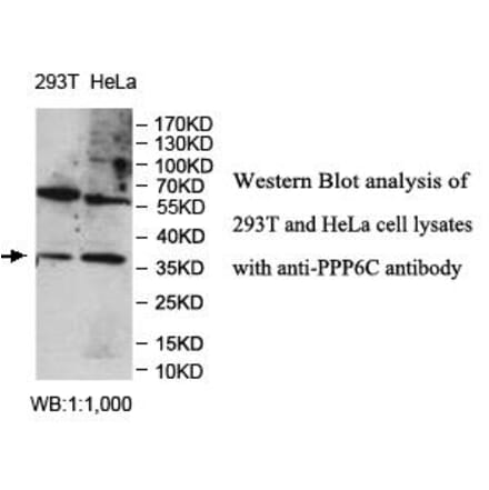 PPP6C Antibody from Signalway Antibody (39981) - Antibodies.com