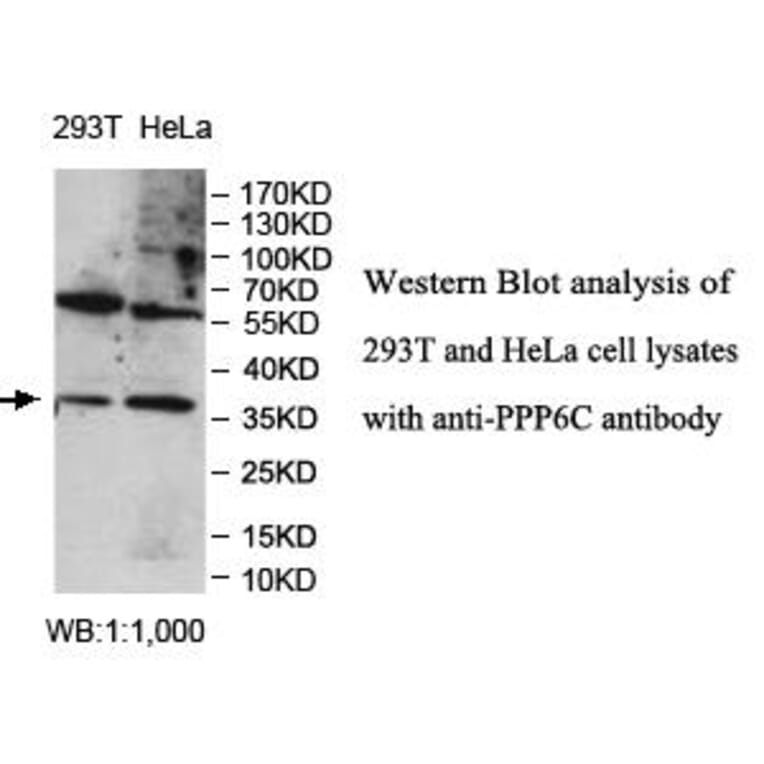 PPP6C Antibody from Signalway Antibody (39981) - Antibodies.com