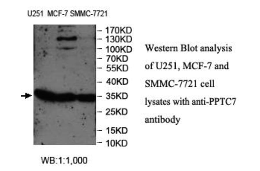 PPTC7 Antibody from Signalway Antibody (39983) - Antibodies.com