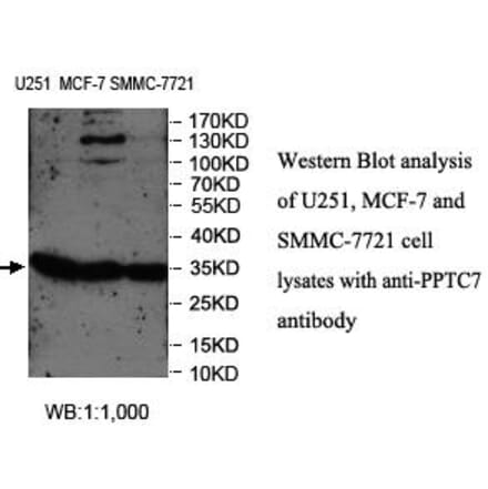 PPTC7 Antibody from Signalway Antibody (39983) - Antibodies.com