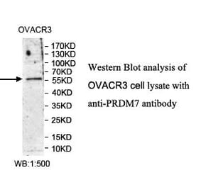 PRDM7 Antibody from Signalway Antibody (39984) - Antibodies.com