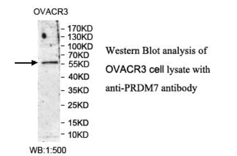 PRDM7 Antibody from Signalway Antibody (39984) - Antibodies.com