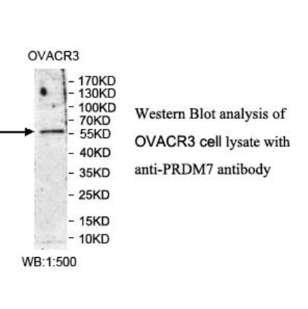 PRDM7 Antibody from Signalway Antibody (39984) - Antibodies.com