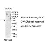 PRDM7 Antibody from Signalway Antibody (39984) - Antibodies.com