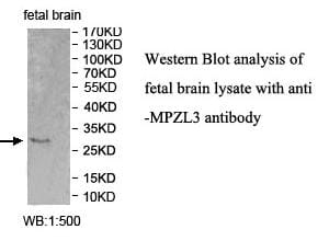 Anti-MPZL3 Antibody