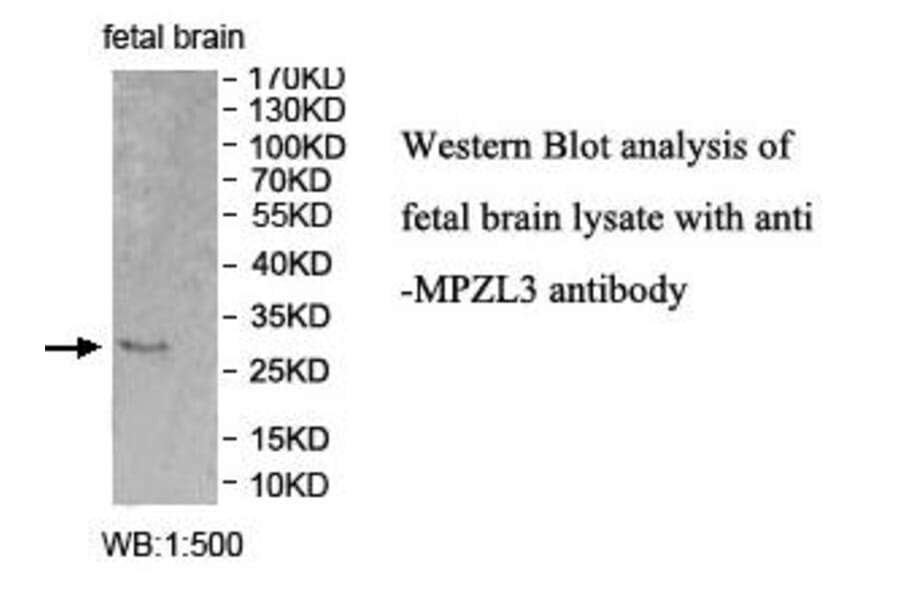MPZL3 Antibody from Signalway Antibody (39995) - Antibodies.com