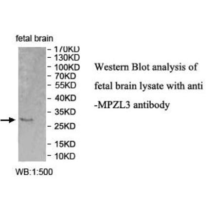 MPZL3 Antibody from Signalway Antibody (39995) - Antibodies.com