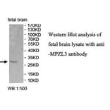 MPZL3 Antibody from Signalway Antibody (39995) - Antibodies.com