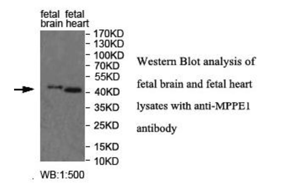 MPPE1 Antibody from Signalway Antibody (39996) - Antibodies.com