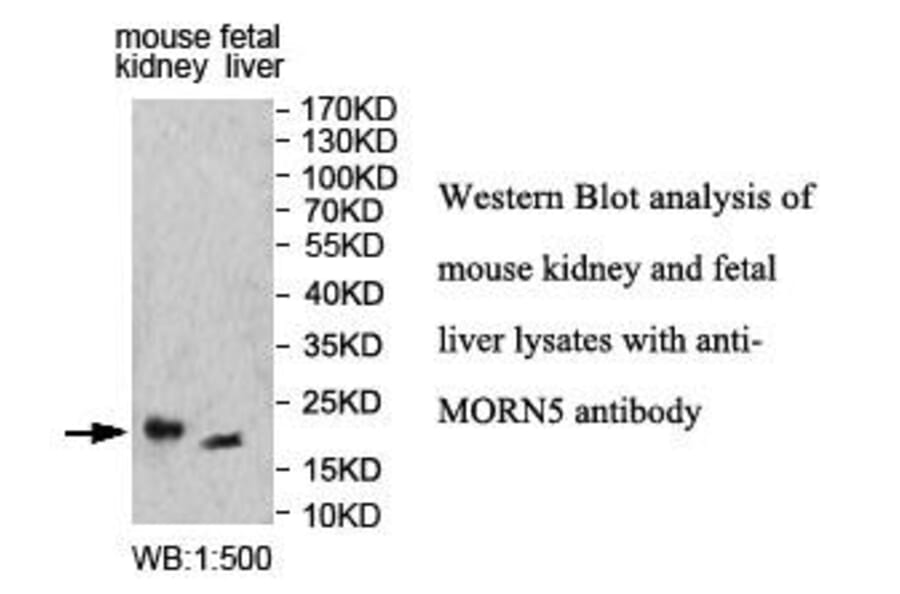MORN5 Antibody from Signalway Antibody (39999) - Antibodies.com