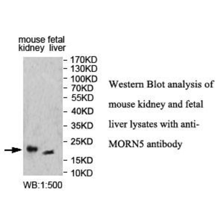 MORN5 Antibody from Signalway Antibody (39999) - Antibodies.com