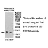 MORN5 Antibody from Signalway Antibody (39999) - Antibodies.com