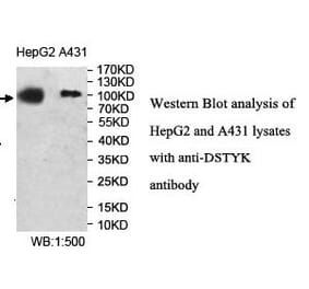 DSTYK Antibody from Signalway Antibody (40006) - Antibodies.com