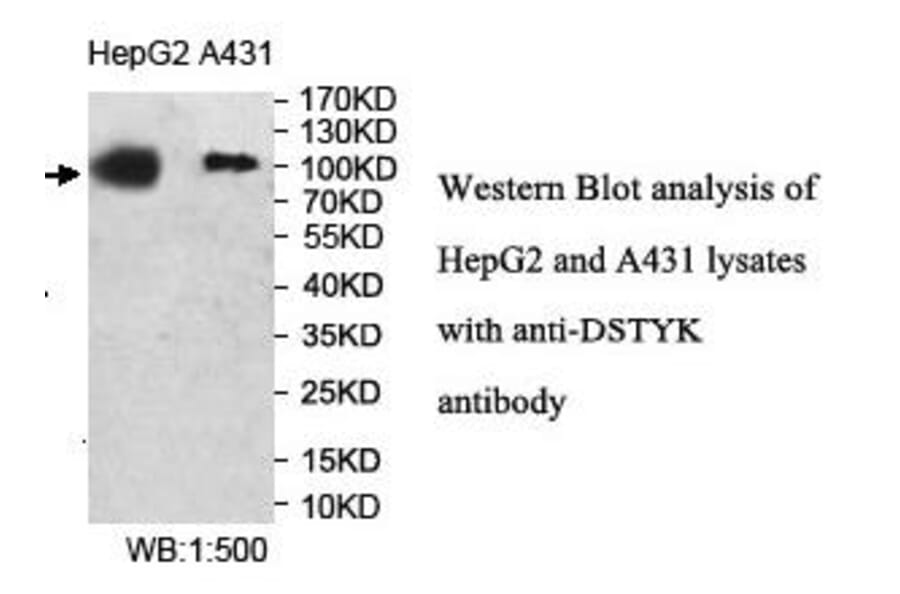 DSTYK Antibody from Signalway Antibody (40006) - Antibodies.com