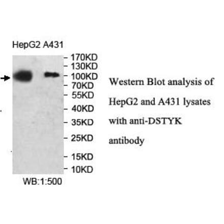 DSTYK Antibody from Signalway Antibody (40006) - Antibodies.com