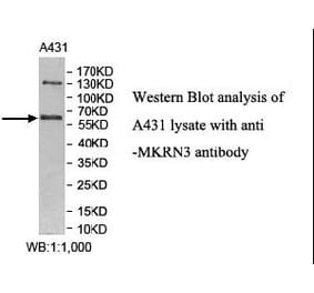 MKRN3 Antibody from Signalway Antibody (40008) - Antibodies.com