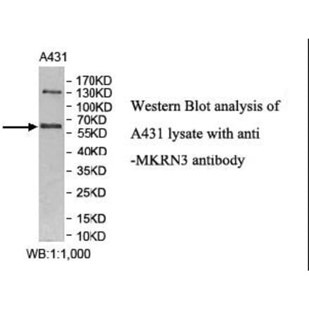 MKRN3 Antibody from Signalway Antibody (40008) - Antibodies.com